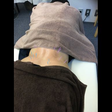 文京区で慢性的な腰の痛み、張り、ぎっくり腰でお悩みの方は千代田区神田大手町のメディカルスポーツ整骨院鍼灸院へ