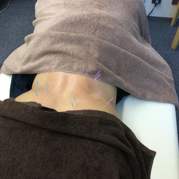 文京区で慢性的な腰の痛み、張り、ぎっくり腰でお悩みの方は千代田区神田大手町のメディカルスポーツ整骨院鍼灸院へ