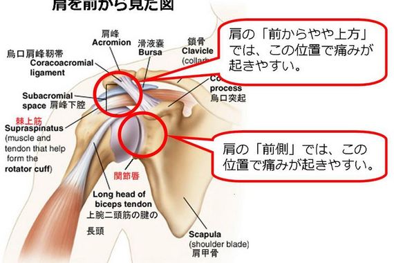 肩関節周囲炎についてとことん考えよう　2.3　計2巻セット 肩関節周囲炎についてとことん考えよう 2.3 計2巻セット
