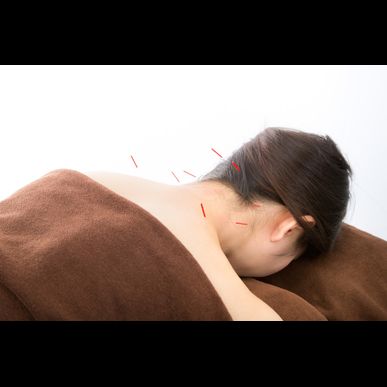 文京区肩こり、腰痛ではり治療は千代田区神田大手町のメディカルスポーツ整骨院鍼灸へ