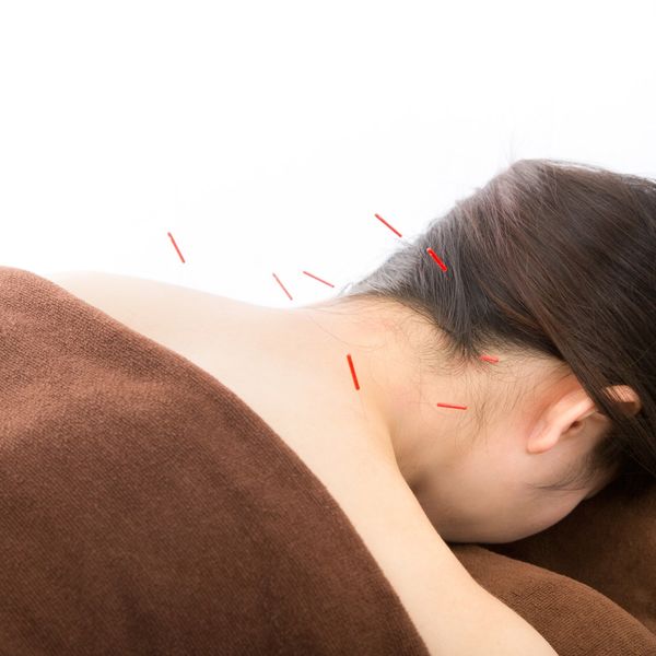 中央区日本橋で肩こり腰痛ははり治療でお勧めの千代田区神田大手町のメディカルスポーツ整骨院鍼灸へ